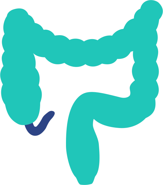 Appendicitis