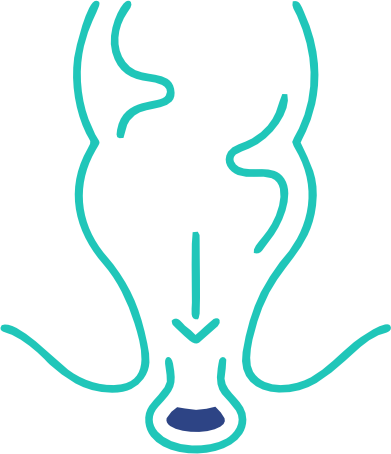 Rectal Prolapse